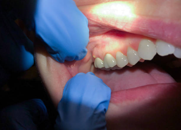 Best Emergency Gum Pain Relief  in Braselton, GA